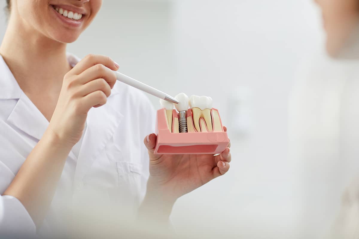 Dental implants in sarasota what to expect before during and after blog
