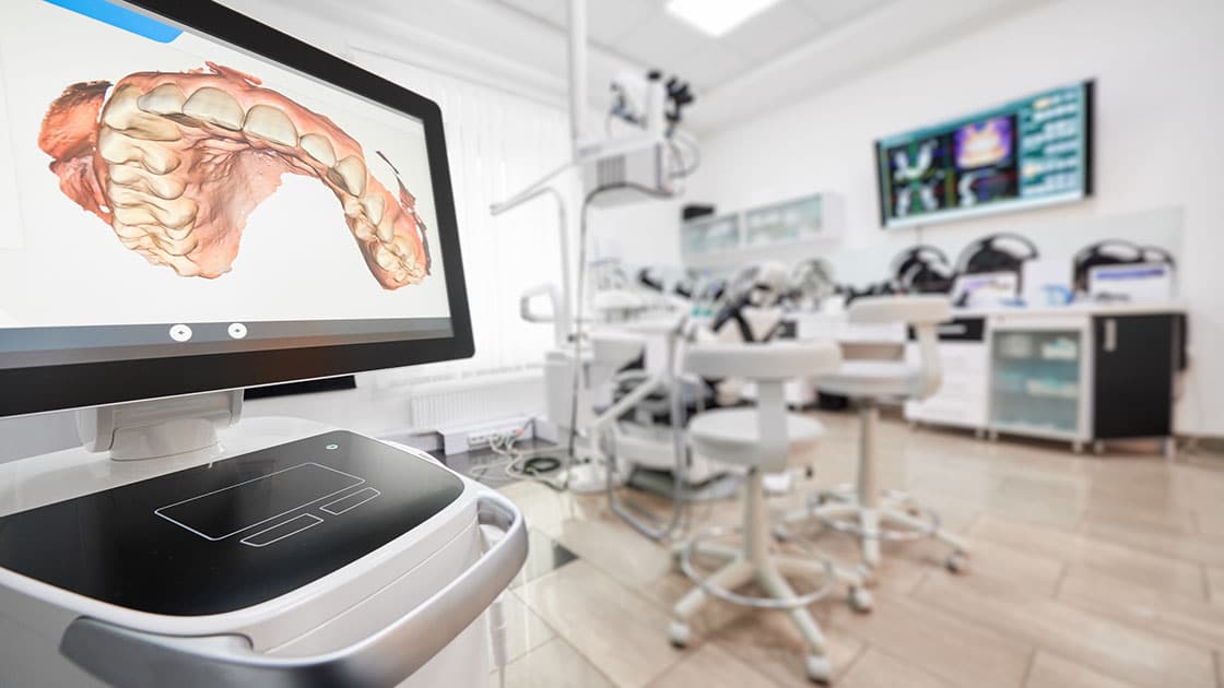 Digital Intraoral Scanner Meadows Dental Associates